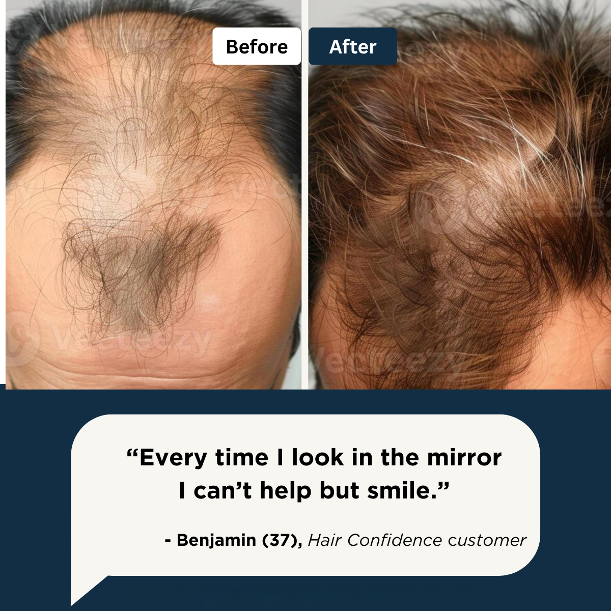 Hair Growth Roll-On Serum
