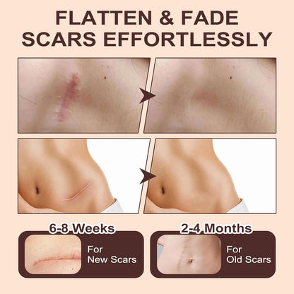 Scar Free Solution Silicone Scar Stick