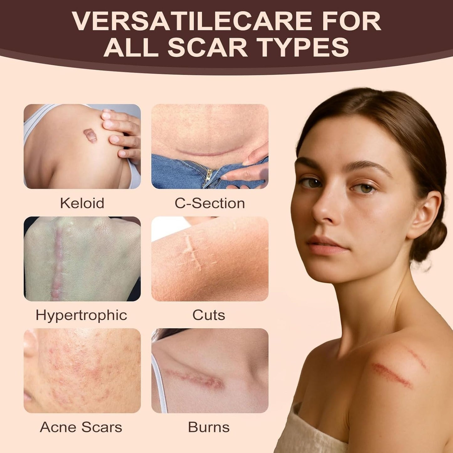Scar Free Solution Silicone Scar Stick