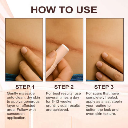 Scar Free Solution Silicone Scar Stick